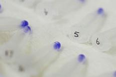 Le besoin est immense de pouvoir détecter la maladie de manière précoce 