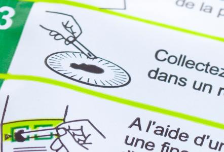 Un test d'analyse des selles pour une détection plus précoce du cancer du pancréas (Visuel Adobe Stock 15892887)
