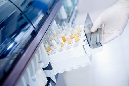 L’analyse de la variation du nombre de copies d'ADN (CNV) dans les cellules exfoliées présentes dans l'urine apporte une meilleure sensibilité et une spécificité similaire dans la détection du carcinome urothélial par rapport à la cytologie urinaire (Visuel Adobe Stock 334065984)