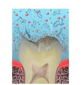 Un nouveau composite, ou un nouveau dentifrice préventif illustreront bientôt cette alternative aux soins actuels : la reminéralisation guidée par les peptides.