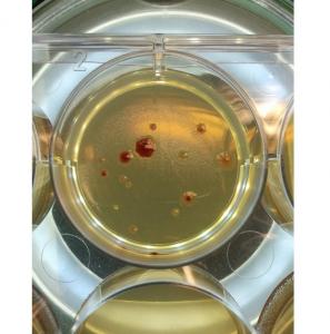 L'antibiorésistance, le fait de quelques microbes solitaires ?