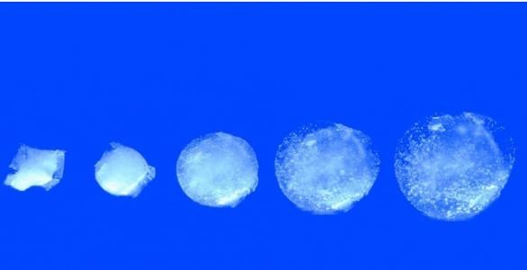 La pilule gonflable comprend un capteur qui surveille en continu la température de l'estomac pendant 30 jours. 