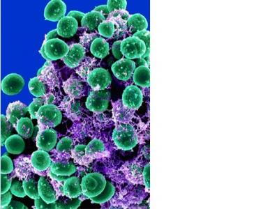 La combinaison triclosanassocié à l’antibiotique tobramycine élimine les cellules qui protègent la bactérie Pseudomonas aeruginosa, jusqu'à 99,9%. 