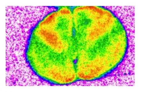 Les souris exposées à long terme au médicament présentent des troubles de la mémoire au point de ne plus pouvoir faire la distinction entre un objet familier et un nouvel objet