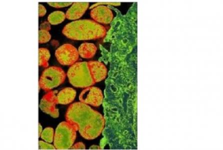 la bactérie qui envahit les cellules épithéliales des voies génitales et urinaires parfois aussi les cellules du rectum et des poumons, peut conduire à l'infertilité dans certains cas.