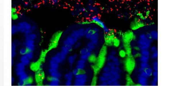 Certaines bactéries (en rouge) apparaissent ainsi associées à un risque réduit d’allergie alimentaire