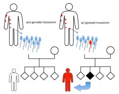 Il s'agit d'une mutation qui du spermatozoïde du père va entraîner une maladie dermatologique chez la fille