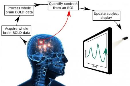 Le neurofeedback est en effet capable de réduire la sévérité des acouphènes ou même de les éliminer chez certains patients. 