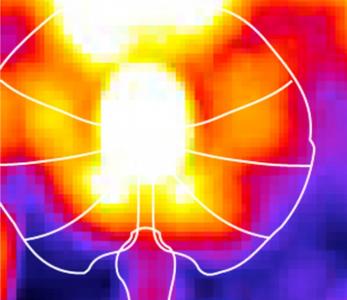 2 types de cellules, situés dans une zone spécifique du cerveau, les noyaux de raphé, jouent un rôle clé dans le contrôle des signaux de la faim