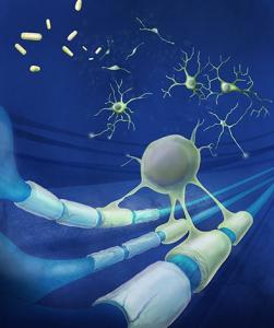 Les patients atteints de lésion cérébrale traumatique et de SEP partagent un mécanisme de fatigue cognitive. 