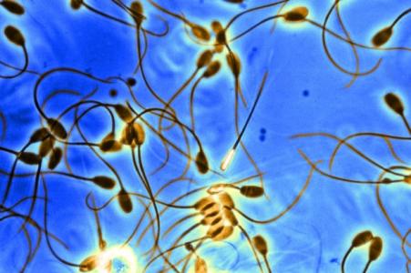 Cette équipe de l’Université de Caroline du Nord réussit la toute première déshydratation, par micro-ondes, puis réhydratation de spermatozoïdes (de chat)