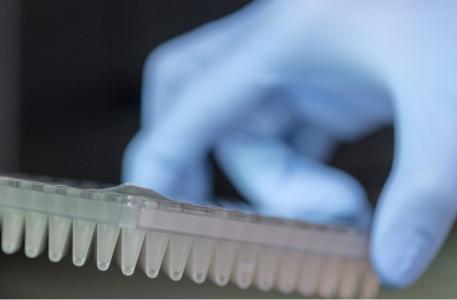 Ce test sanguin peut prédire la résistance tumorale prostatique face aux principaux anticancéreux