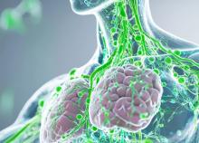 Un flux lymphatique plus rapide dans les jambes pourrait prédire une meilleure réponse aux diurétiques dans l'insuffisance cardiaque aiguë (ViSuel Adobe Stock 1024415085) Un flux lymphatique plus rapide dans les jambes pourrait prédire une meilleure réponse aux diurétiques dans l'insuffisance cardiaque aiguë (ViSuel Adobe Stock 1024415085)