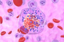 La dexaméthasone, hormone de stress synthétique, pourrait réduire les métastases du cancer du sein (Visuel Adobe Stock 1031587846) La dexaméthasone, hormone de stress synthétique, pourrait réduire les métastases du cancer du sein (Visuel Adobe Stock 1031587846)