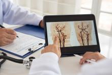 L'inversion des altérations des lipoprotéines chez les patients victimes d'un AVC ischémique ouvre peut-être de nouvelles perspectives thérapeutiques dans la gestion des maladies cardiovasculaires (Visuel Adobe Stock 1106737954)