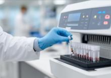 C’est une avancée vers une détection précoce et simple de la maladie de Parkinson dans le sang (Visuel Adobe Stock 1587772596) C’est une avancée vers une détection précoce et simple de la maladie de Parkinson dans le sang (Visuel Adobe Stock 1587772596)