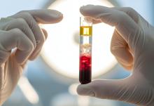 Ces travaux révèlent ainsi de nouvelles et précieuses fonctions des plaquettes sanguines ainsi que leur potentiel inexploité de marqueurs génétiques pour les biopsies liquides (Visuel Adobe Stock 1644339697) Ces travaux révèlent ainsi de nouvelles et précieuses fonctions des plaquettes sanguines ainsi que leur potentiel inexploité de marqueurs génétiques pour les biopsies liquides (Visuel Adobe Stock 1644339697)