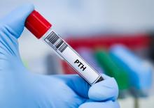 L'hormonothérapie pourrait bloquer les signaux nerveux, sources de douleur dans la colonne vertébrale vieillissante (Visuel Adobe Stock 1876409285) L'hormonothérapie pourrait bloquer les signaux nerveux, sources de douleur dans la colonne vertébrale vieillissante (Visuel Adobe Stock 1876409285)