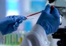 Un test sanguin, qualifié de révolutionnaire, permet de diagnostiquer l'encéphalomyélite myalgique (ME) ou fatigue chronique (CFS : Chronic Fatigue Syndrome), une maladie encore négligée, mal détectée et difficile à diagnostiquée car partageant de nombreux symptômes avec d’autres pathologies (Visuel Adobe Stock 233950564) Un test sanguin, qualifié de révolutionnaire, permet de diagnostiquer l'encéphalomyélite myalgique (ME) ou fatigue chronique (CFS : Chronic Fatigue Syndrome), une maladie encore négligée, mal détectée et difficile à diagnostiquée car partageant de nombreux symptômes avec d’autres pathologies (Visuel Adobe Stock 233950564)