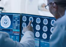 Des changements de forme du cerveau constituent des signes avant-coureurs de démence (Visuel Adobe Stock 236237463) Des changements de forme du cerveau constituent des signes avant-coureurs de démence (Visuel Adobe Stock 236237463)