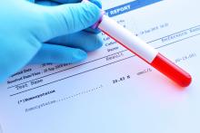 La réduction de la cystéine, un acide aminé, favorise la perte de poids (Visuel Adobe Stock 243324612)