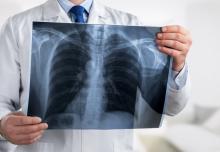 L'analyse annuelle d'images informatisée, notamment via l’IA, pourrait offrir un moyen plus précoce et plus objectif d'identifier les patients présentant un risque élevé d'aggravation de la maladie (Visuel Adobe Stock 276455512). L'analyse annuelle d'images informatisée, notamment via l’IA, pourrait offrir un moyen plus précoce et plus objectif d'identifier les patients présentant un risque élevé d'aggravation de la maladie (Visuel Adobe Stock 276455512).