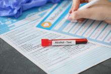 La plus grande partie du grand public ne fait pas le lien entre alcool et cancer (Visuel Adobe Stock 321950771)