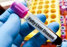 L'étude révèle comment certaines hormones peuvent inverser la stéatose hépatique (Visuel Adobe Stock 764582361)