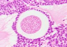 Cet ovaroïde va permettre une meilleure compréhension et le développement de nouveaux traitements pour les anomalies ou différences de développement sexuel (DDS) et l'infertilité (Visuel Adobe Stock 826191555).