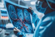 Cette accumulation de protéines dans les vaisseaux sanguins cérébraux génère un risque accru de démence à 5 ans (Visuel Adobe Stock 915110411) Cette accumulation de protéines dans les vaisseaux sanguins cérébraux génère un risque accru de démence à 5 ans (Visuel Adobe Stock 915110411)