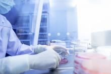 Cette recherche s’attache à décrypter les mécanismes par lesquels un type courant de bactérie, Staphylococcus aureus, s'adapte aux conditions de vie sur le corps humain, y compris aux conditions qui visent à l’éliminer (Visuel Adobe Stock 320678643)