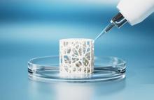 Ce verre bioactif imprimable qui présente de nombreuses similitudes avec le tissu osseux, est tout à fait efficace comme substitut osseux (Visuel Adobe Stock 1324028968) Ce verre bioactif imprimable qui présente de nombreuses similitudes avec le tissu osseux, est tout à fait efficace comme substitut osseux (Visuel Adobe Stock 1324028968)